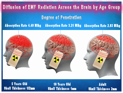 EMF microwave radiation diffusion affection the brain of three age groups