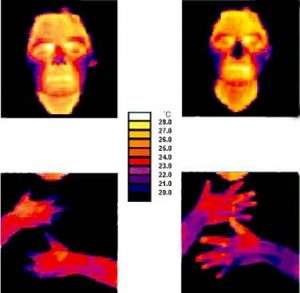ADR Protect Thermographic Study